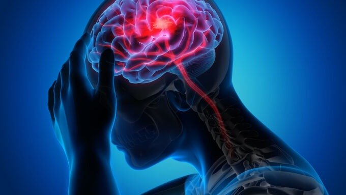 Signs of Stroke You Should Never Ignore